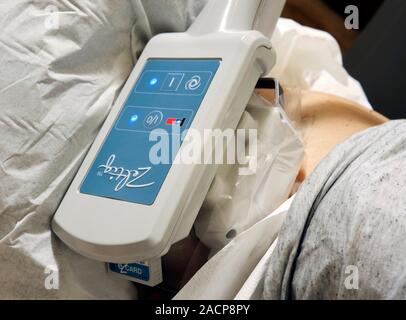 Cryolipolysis treatment. Cryolipolysis machine on the abdomen of a woman during a treatment session. Cryolipolysis is a non-invasive procedure for the Stock Photo