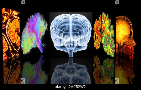 Conceptual computer artwork depicting neurology. From left to right: MRI brain scans, 3D dsi white matter brain scan, brain, Alzheimer's brain versus Stock Photo