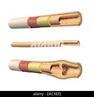 Blood vessels. Artwork of an artery (top), capillary (middle) and vein (bottom). From inside to out, arteries and veins are made of: a thin layer (int Stock Photo
