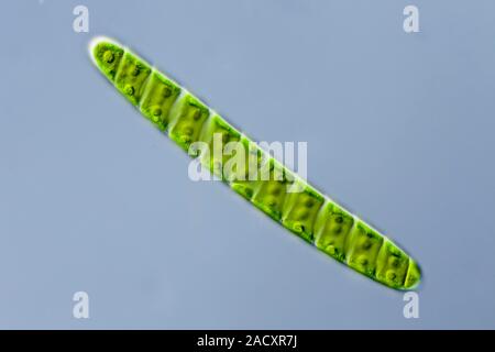 Light micrograph of Spirotaenia sp., a freshwater green alga, showing the spiraled chloroplast. Microscopic contrast method: Differential interference Stock Photo
