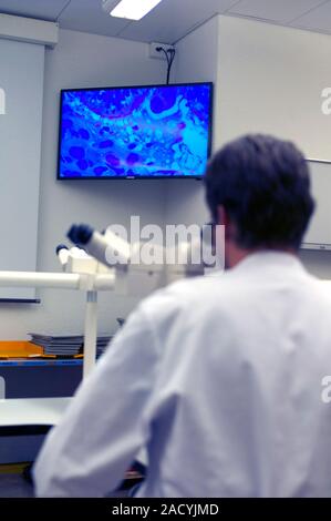 Medical research, tissue sample. Medical student using a light microscope to examine a tissue sample (on screen) that has been stained to help identif Stock Photo