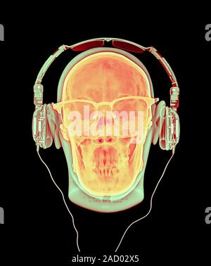 Skull with headphones and glasses, coloured X-ray. Stock Photo