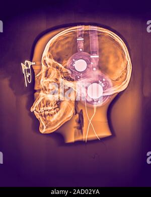 Skull with headphones and glasses, coloured X-ray. Stock Photo