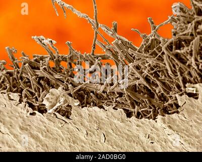 Broken egg shell, coloured scanning electron micrograph (SEM). This is the edge of a piece of a chicken's egg shell, viewed from the inside and showin Stock Photo
