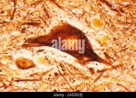 Light micrograph of nerve cell (neurone) from the human spinal cord. All neurones have a similar basic structure, consisting of a central cell body co Stock Photo