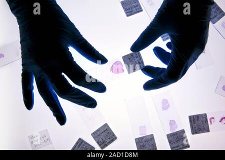 Histology tissue sample preparation. Close-up of a histologist preparing tissue samples on glass slides for examination under a microscope. The sample Stock Photo
