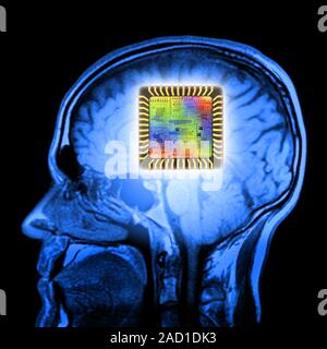 Artificial intelligence and cybernetics, conceptual image. This image of a computer chip structure, superimposed on a mri (magnetic resonance image) o Stock Photo