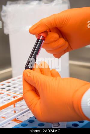 Blood sample analysis. Close-up of a blood sample in a vacutainer being handled by a laboratory researcher. Stock Photo