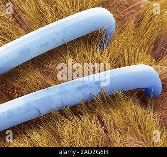 Surgical staples. Coloured scanning electron micrograph (SEM) of surgical staple in a repair of dog skin. Surgical staples are specialized staples use Stock Photo