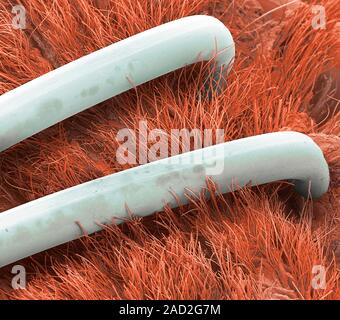 Surgical staples. Coloured scanning electron micrograph (SEM) of surgical staple in a repair of dog skin. Surgical staples are specialized staples use Stock Photo