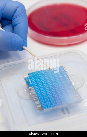Hospital pathology lab. Close-up of a microbiologist preparing a sample plate for analysis in the pathology lab of a hospital. Stock Photo