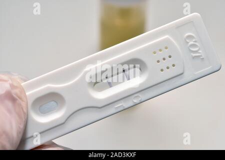 Smoking urine test kit. Person holding a NicoScreen kit used to test urine  for the presence of cotinine (a by-product of nicotine) in order to determi  Stock Photo