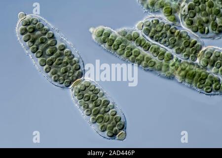 Light micrograph of Nostoc pruniforme colonies showing several round cyanobacteria cells in elongate spherical mucilage aggregations. Culture material Stock Photo