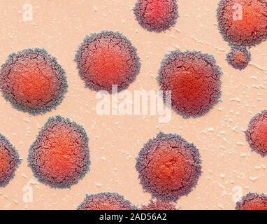 Bacterial colonies. Scanning electron micrograph (SEM) of a bacterial culture. Colonies of bacteria growing in a petri dish. The petri dish contains a Stock Photo
