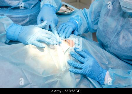 Close up of surgery team operating. The operation on the eye. Cataract surgery. Laser vision correction. Patient and team of surgeons in the operating Stock Photo