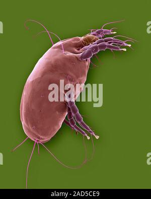 Coloured scanning electron micrograph (SEM) of Dust mite (Dermatophagoides pteronyssinus). Millions of dust mites inhabit the home, feeding on dead hu Stock Photo