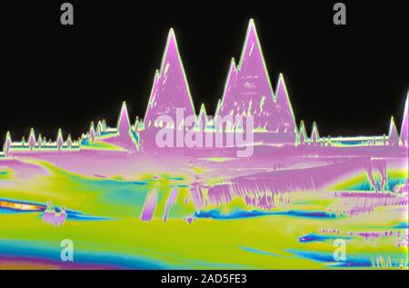 Light micrograph (LM) of Vitamin A crystals. Vitamin A (retinol or retinoic acid) is a fat-soluble (lipophilic) vitamin essential for the synthesis of Stock Photo