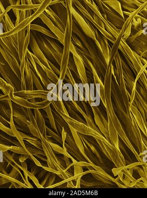 Coloured scanning electron micrograph (SEM) of Cotton (100%) flannel fabric. Cotton is a natural fibre obtained from several plants belonging to the G Stock Photo