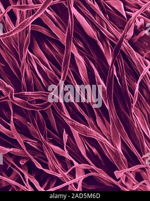 Coloured scanning electron micrograph (SEM) of Cotton (100%) flannel fabric. Cotton is a natural fibre obtained from several plants belonging to the G Stock Photo