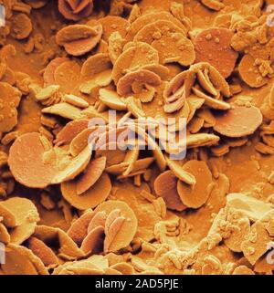 Rust. Coloured scanning electron micrograph (SEM) of rust on an metal staple. Rust is iron oxide. It forms when moisture and air act on unprotected me Stock Photo