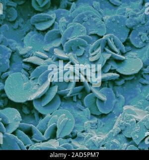 Rust. Coloured scanning electron micrograph (SEM) of rust on an metal staple. Rust is iron oxide. It forms when moisture and air act on unprotected me Stock Photo