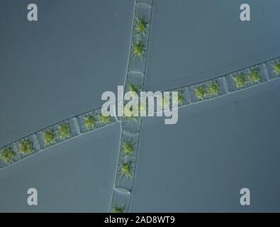 Green Algae Under The Microscope 100x Stock Photo Alamy