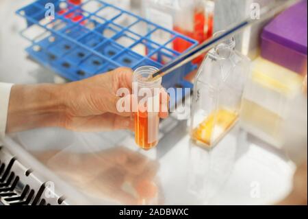 Pipetting a blood sample. Pipette being used to process a blood sample for testing in a laboratory. Blood is analysed for levels of components such as Stock Photo