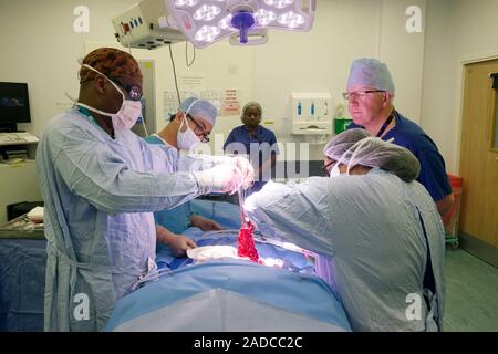 Intestinal surgery. Surgical team operating to remove part of a patient's intestines. The team includes a specialist in colorectal cancer surgery. Pho Stock Photo