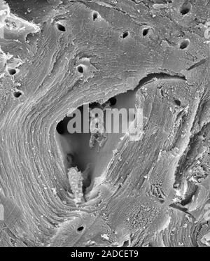 Pear fruit (Pyrus sp.) sclerenchyma cell, scanning electron micrograph (SEM). Section through a pear fruit revealing a sclereid, also known as a stone Stock Photo