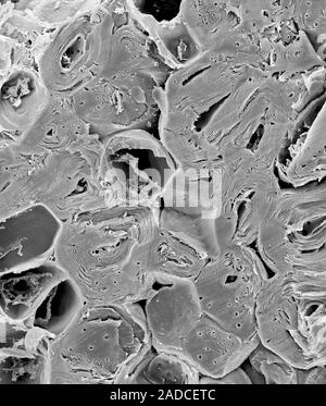 Pear fruit (Pyrus sp.) sclerenchyma cells, scanning electron micrograph (SEM). Shown here is a section through a pear fruit revealing a cluster of scl Stock Photo