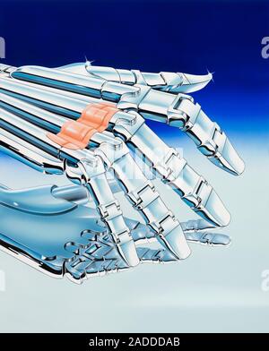 Cybernetic medicine. Conceptual image of a robot hand with a plaster, representing the use of cybernetic implants in medicine. These can range from im Stock Photo