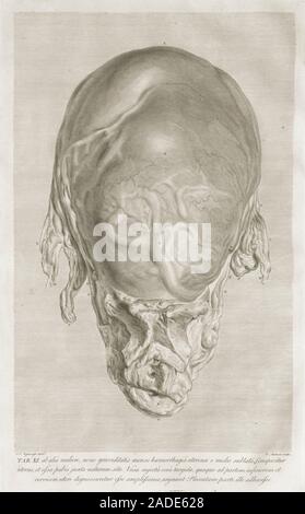 William Hunter on the anatomy of human pregnancy, 1774. This page, showing the uterus of a woman who died in the ninth month of pregnancy, is from 'An Stock Photo