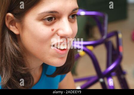 Young white student, who has cerebral palsy and uses a walking frame, in study group. Stock Photo