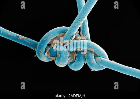 Images not to be used by the tobacco industry. Surgical thread from sutured head wound, coloured scanning electron micrograph (SEM). The surgical thre Stock Photo