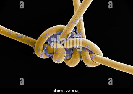 Images not to be used by the tobacco industry. Surgical thread from sutured head wound, coloured scanning electron micrograph (SEM). The surgical thre Stock Photo