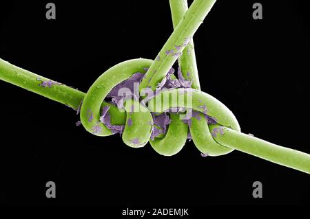Images not to be used by the tobacco industry. Surgical thread from sutured head wound, coloured scanning electron micrograph (SEM). The surgical thre Stock Photo