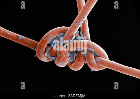 Images not to be used by the tobacco industry. Surgical thread from sutured head wound, coloured scanning electron micrograph (SEM). The surgical thre Stock Photo