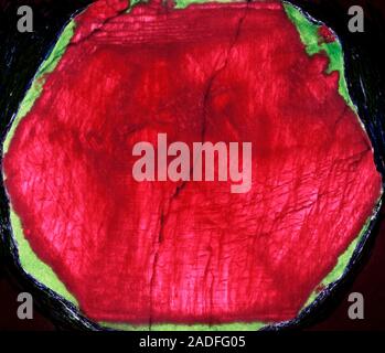 Large ruby. Thin slice of a large ruby embedded in zoisite (green). It is 10 centimetres in diameter. The illumination of the thin slice from behind h Stock Photo