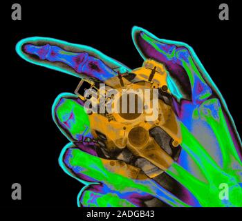 Stopwatch. Coloured X-ray of a hand holding a stopwatch. The thumb is pressing a button that will accurately stop or start the watch. The electronics Stock Photo