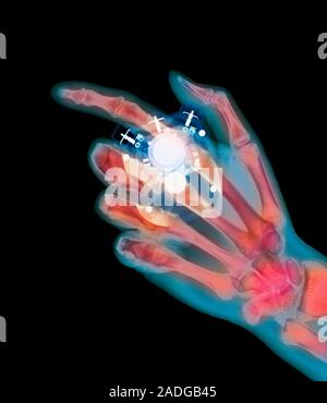 Stopwatch. Coloured X-ray of a hand holding a stopwatch. The thumb is pressing a button that will accurately stop or start the watch. The electronics Stock Photo
