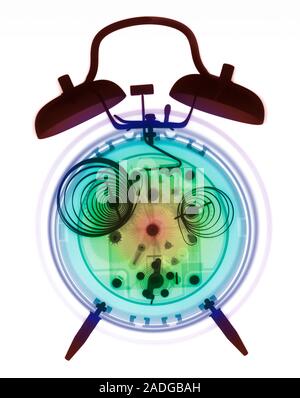 Alarm clock. Coloured X-ray of an alarm clock. The coiled springs and cogs of the internal mechanism are seen. The hammer (upper centre) is designed t Stock Photo