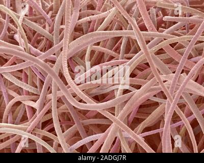 Wool. Coloured scanning electron micrograph (SEM) of wool from a sheep. The cuticle (outer layer) of the hair comprises overlapping scales. Stock Photo