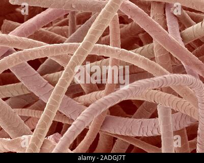 Wool. Coloured scanning electron micrograph (SEM) of wool from a sheep. The cuticle (outer layer) of the hair comprises overlapping scales. Stock Photo