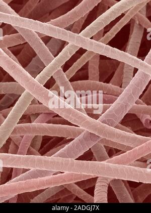 Wool. Coloured scanning electron micrograph (SEM) of wool from a sheep. The cuticle (outer layer) of the hair comprises overlapping scales. Stock Photo