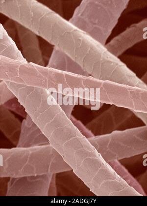 Wool. Coloured scanning electron micrograph (SEM) of wool from a sheep. The cuticle (outer layer) of the hair comprises overlapping scales. Stock Photo