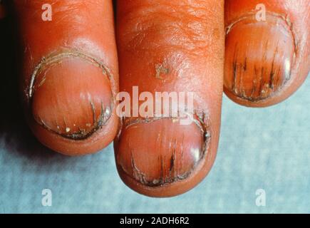 Don't ignore your fingernails (stolen from IG) : r/coolguides