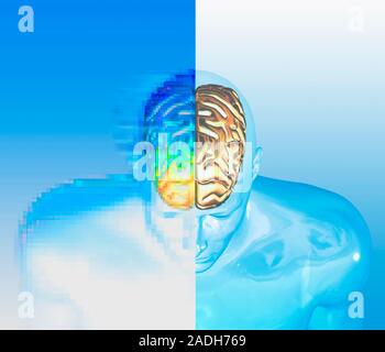 Alzheimer's disease. Conceptual computer artwork showing a glass figure with a golden brain. One side of the image is pixellated and the brain is colo Stock Photo