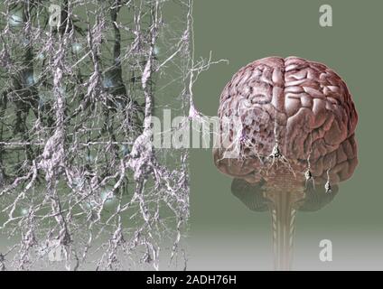 Alzheimer's disease. Conceptual computer artwork of a brain affected by Alzheimer's disease. The condition causes the death of brain cells (seen at le Stock Photo