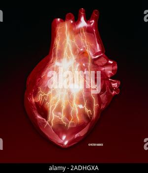 Heart attack. Conceptual computer artwork of bolts of lightning on a heart, representing a heart attack (myocardial infarction). The heart (red) is a Stock Photo