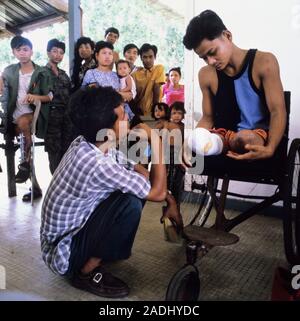 Disability. Therapist assessing the needs of a double leg amputee. This man lost his legs in a land mine explosion. Photographed in Cambodia, where th Stock Photo